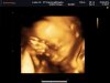 BABY_0004.jpg