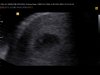 1E ECHO 6 WKN_0000.jpg