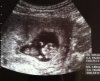 echo 2 mei 2012.jpg