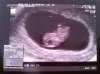 Echo 7 mei 2012 1.jpg