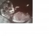 nub baby 3 deel 2.jpg