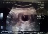 Echo 6w6d.jpg