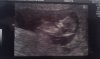 11w5d(12w2d).jpg