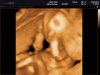 BABY BRUGGE_0008.jpg