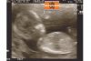 ek echo 14 wkn.jpg