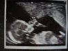 7. ander kindje duimt ook 15w 1d.jpg