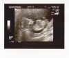echo 24-05-2012_0004.jpg
