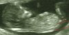 baby 001.jpg