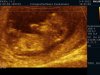 12-09-03-183249_WEKEN_20120903_183249_0018.jpg