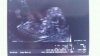 IMG-20120821-WA0000.jpg