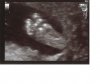 Voetje 20 wk echo.jpg