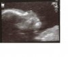 Profiel 20 wk echo.jpg