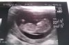 10-09-12 11,3week.jpg