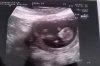 10-09-2012 11,3week.jpg