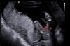BABY TUPARIA_0009.jpg