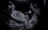 BABY TUPARIA_0007.jpg