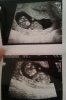 echo 10wk.jpg