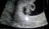 20120912_131425.jpg