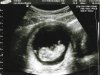 Scan Baby foto 1.jpg