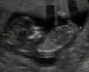 Image3.jpg