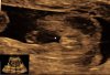 baby_56 - kopie.jpg