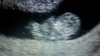 20160104_155953.jpg