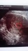 Baby 1.jpg