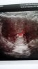 Baby 2.jpg
