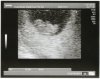 Echo 1(2).jpg
