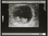 Echo 2 (2).jpg
