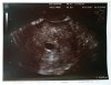 echo 4.5 week-klein.jpg