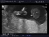 pollenus_20160114_OB-_TRIM-_2_0012.jpg