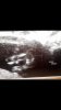 Screenshot_2016-01-20-20-31-42.jpg