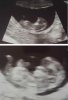 Echo 11 wk bijgeknipt.jpg
