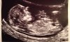 IMG-20160205-WA0004.jpg