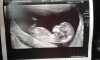 IMG-20160205-WA0000.jpg