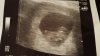 IMG-20160208-WA0008.jpg