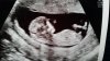 20160209_143531.jpg