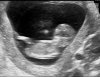 189809449_20160209_ABD-_1E-_TRIM-U-__0001-1.jpg