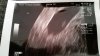 20160225_114320.jpg