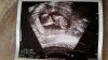 20160301_134302.jpg