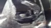 20160302_161648.jpg