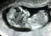 baby.2-3-2016.jpg