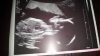 20160307_200547.jpg