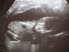 11mrt15wk16 (4).jpg