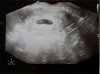 20160317_213835.jpg