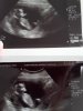 Echo 12w5d.jpg