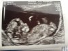 baby1.jpg