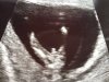 baby2.jpg