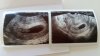 20160411_100133.jpg